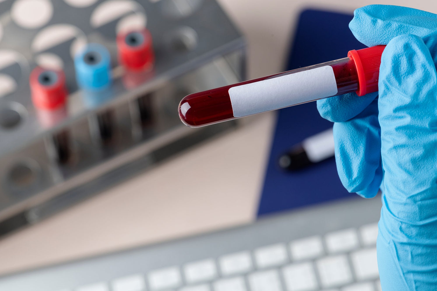 Hematopoyécticos